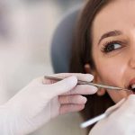 invisalign Bristol